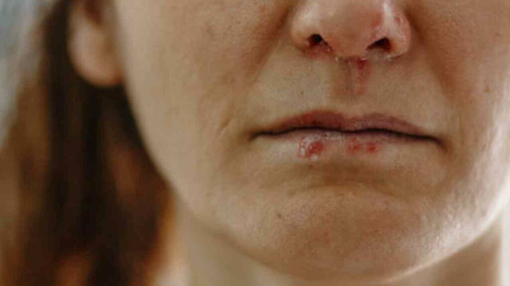 Carcere di Foggia: detenuto aggredisce infermiera colpendola al viso con un pugno